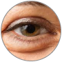 14-puffy-eyes-1 14-puffy-eyes-1