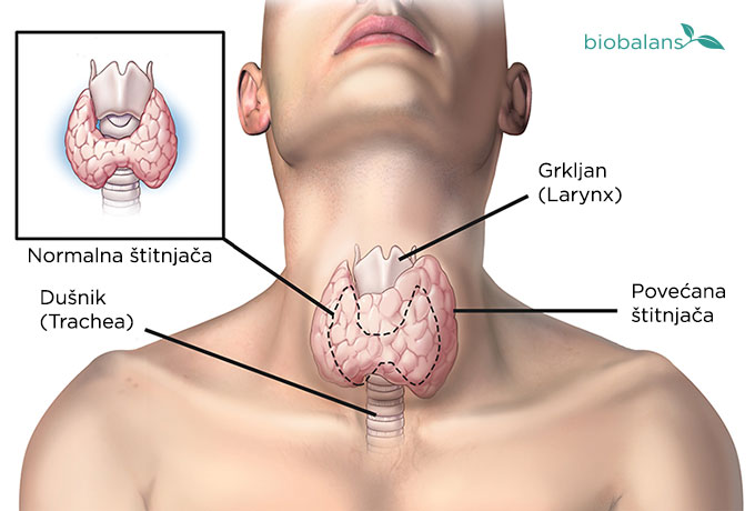 image-1-zasto-je-stitnjaca-vazna image-1-zasto-je-stitnjaca-vazna