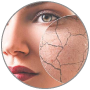 f-dry-skin-1 f-dry-skin-1